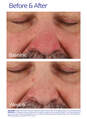 Rozatrol&reg; (Travel Size)  hi-res 画像番号 8